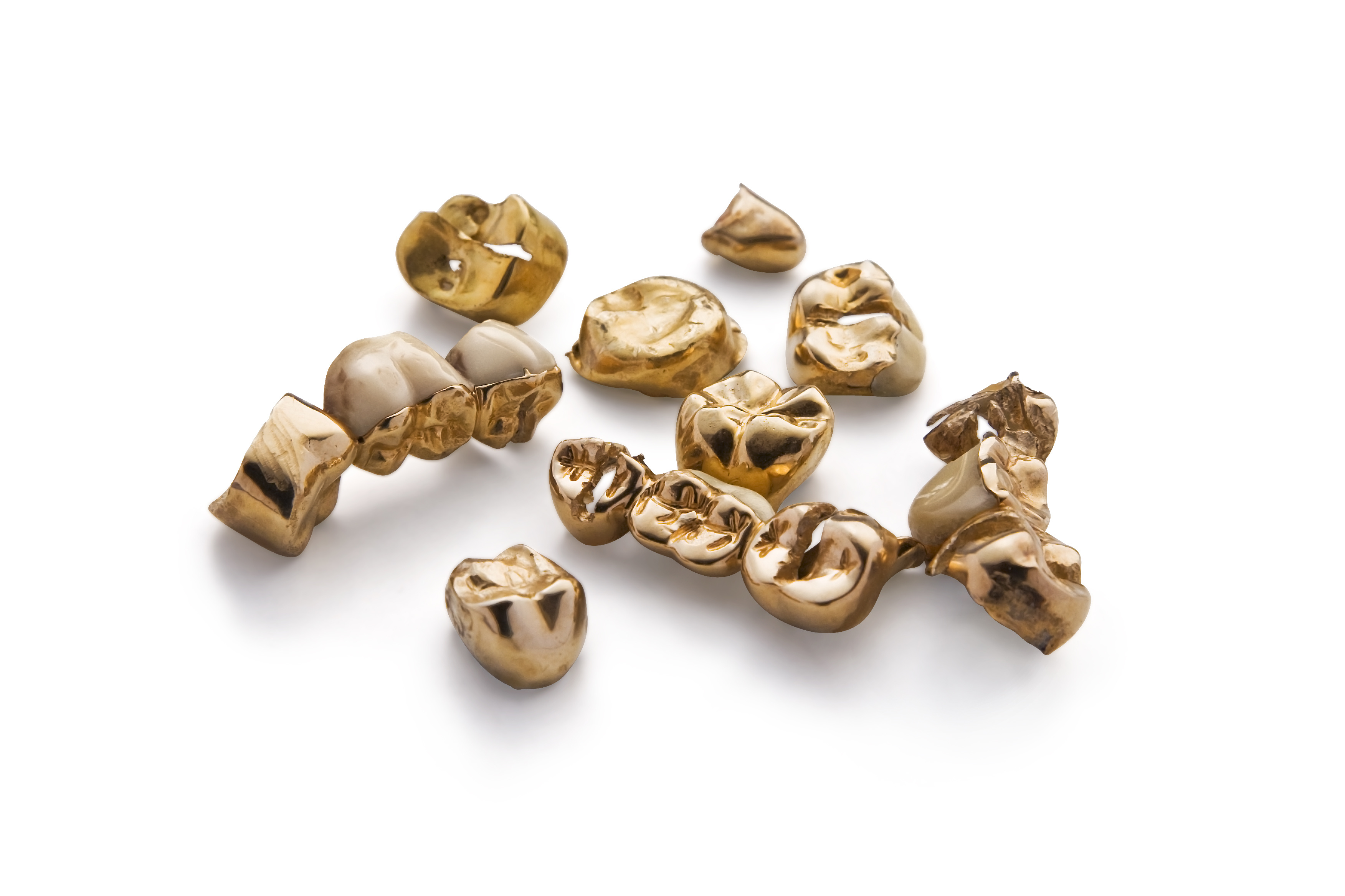 Zahngold Goldzahn verschiedene Arten